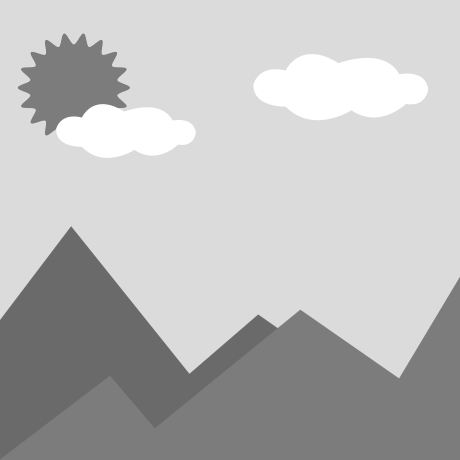 What is the difference between Type A and Type B sprockets?